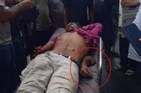 ٹوٹو کو ایمبولینس کی ٹکر، ڈرائیور کا ہاتھ کٹ کر سڑک پر گر گیا! دورگاپور میں خوفناک واقعہ