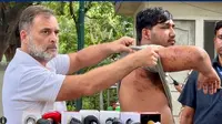 پیپر لیک احتجاج: زخمی طالب علم کو میڈیا کے سامنے لائے راہل گاندھی، کہا- ’حکومت طلبہ کو ڈرانا اور مارنا بند کرے‘