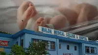 غذائیت کی کمی کی وجہ سے اگست میں مالداہ میڈیکل کالج میں 89 بچے مارے گئے