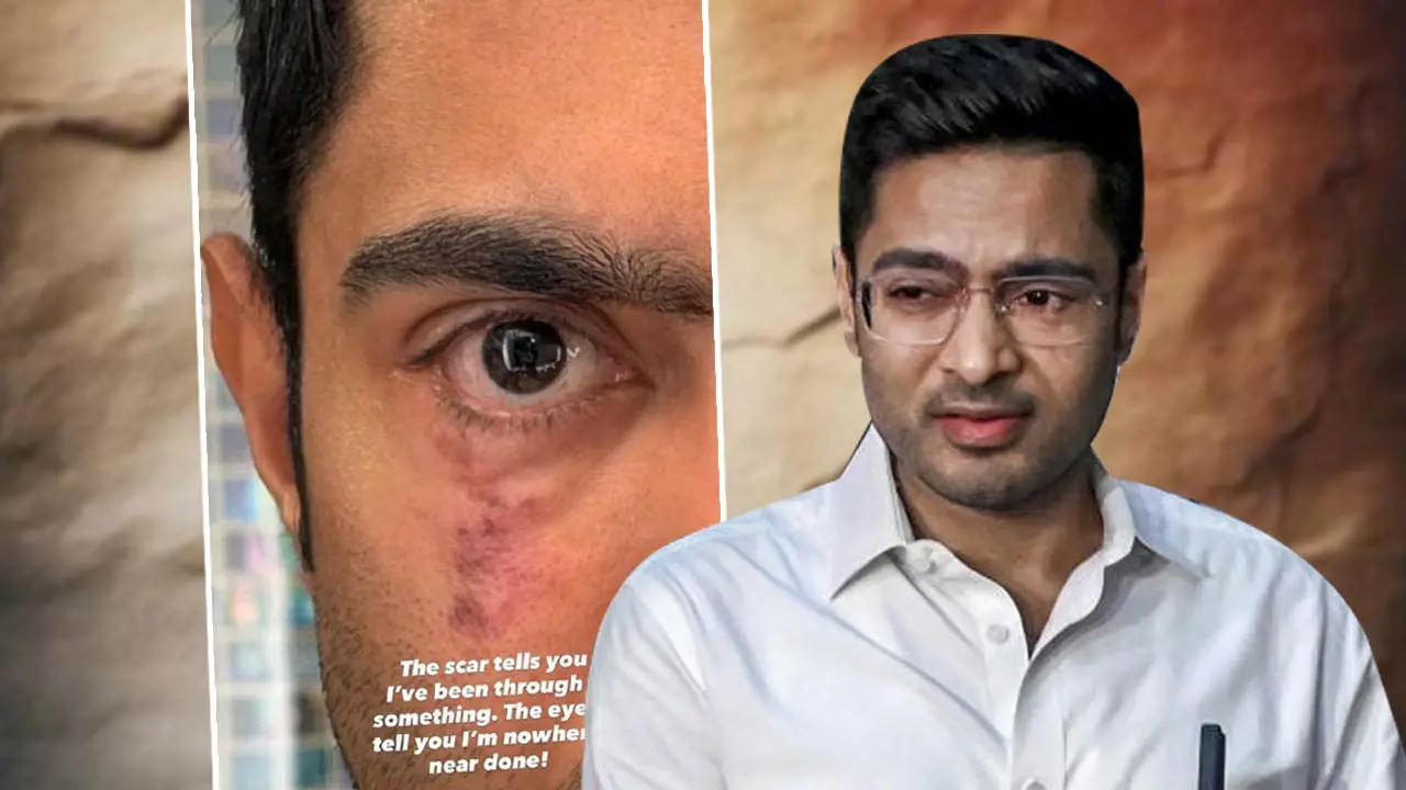 میں ابھی ختم نہیں ہوا“! امریکہ سے آنکھ کی تصویر انسٹاگرام پر پوسٹ کرکے ابھیشیک کا اشاروں بھرا پیغام