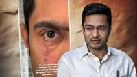 میں ابھی ختم نہیں ہوا“! امریکہ سے آنکھ کی تصویر انسٹاگرام پر پوسٹ کرکے ابھیشیک کا اشاروں بھرا پیغام