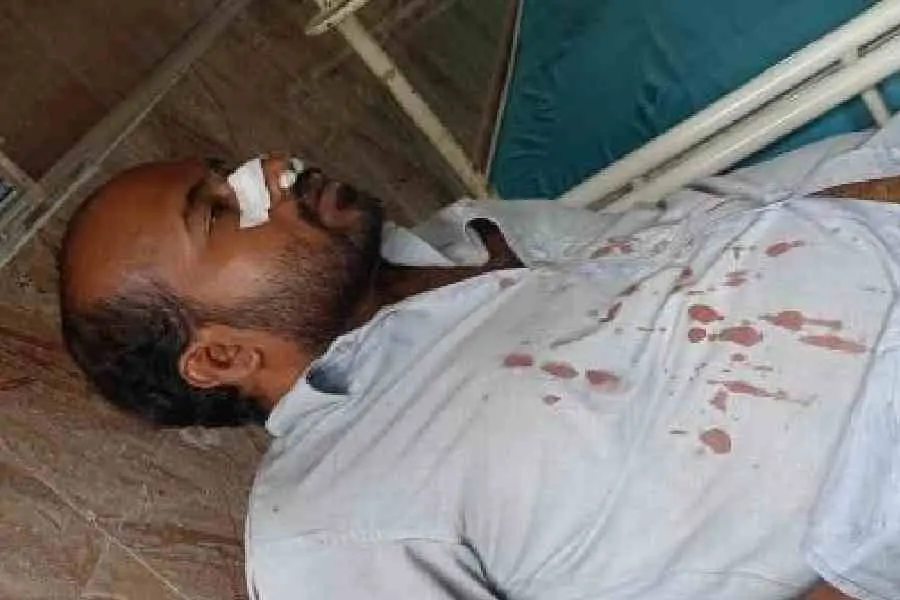 ریلی کے دوران بی جے پی اور اے بی وی پی کا ،اے آئی ڈی ایس اوپر حملہ، 40مظاہرین زخمی